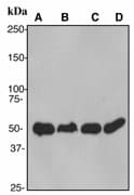IHC-plus™ Monoclonal Rabbit anti-Human PABPN1 / PABP2 Antibody (clone EP3001Y, Internal, IHC, WB)