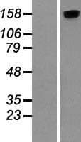 ROCK2 Protein (Over-Expression Lysate Myc-DDK (Flag))
