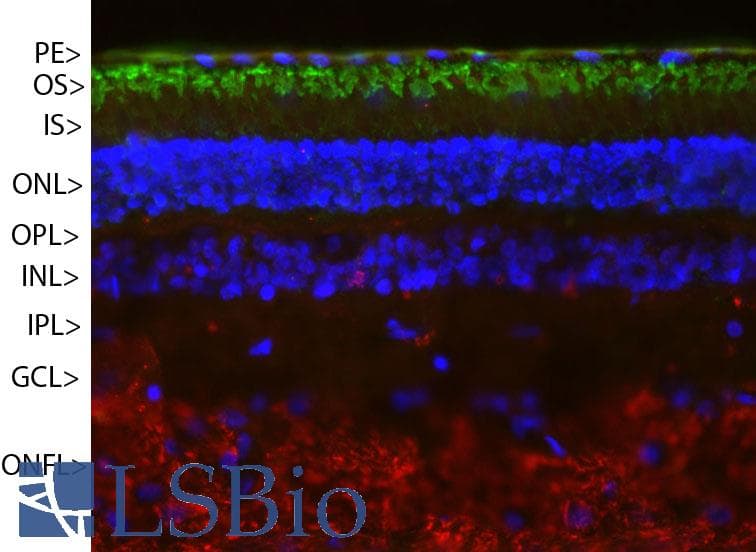 IHC-plus™ Monoclonal Mouse anti-Human Rhodopsin / RHO Antibody (clone A531, IHC, IF, WB)