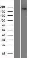 Human XRN1 Protein (Over-Expression Lysate Myc-DDK (Flag))