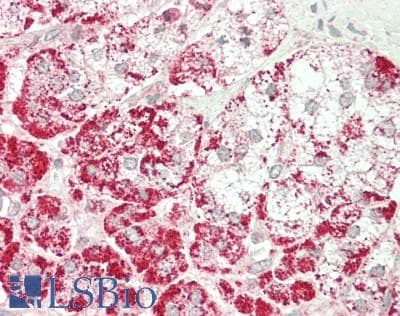 IHC-plus™ Polyclonal Rabbit anti-Human ALDP / ABCD1 Antibody (IHC, WB)