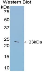 GAA / Alpha-Glucosidase, Acid Antibody (aa782-953)