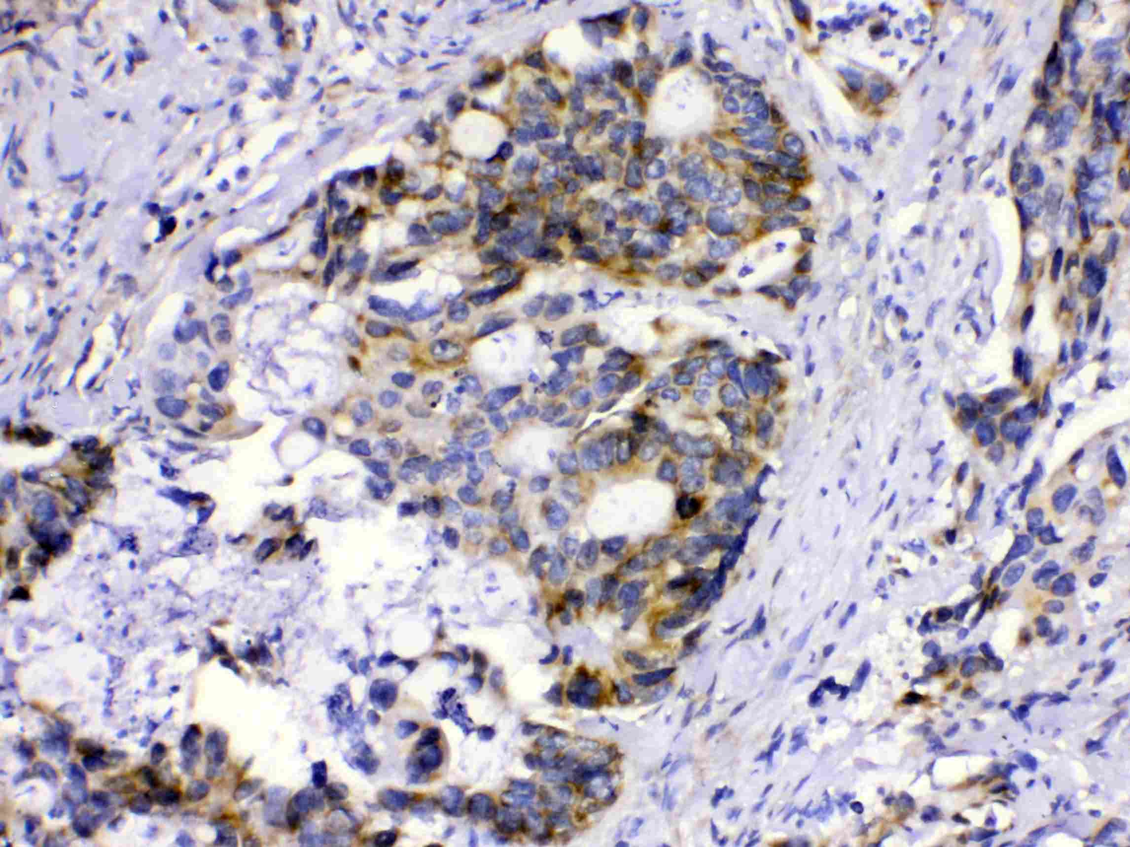 MUT / MCM Antibody