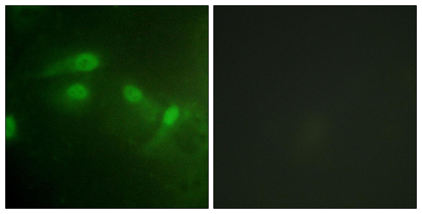 MDM2 Antibody (phospho-Ser186+Ser188)