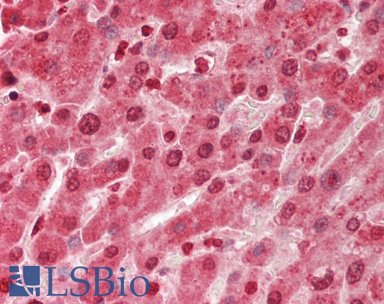 PBRM1 / BAF180 / PB1 Antibody (aa31-80)