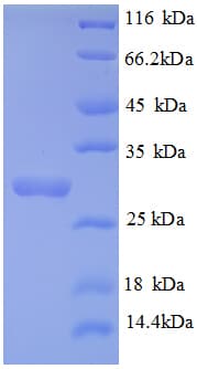 Human COL4A3 / Tumstatin Protein (Recombinant His)