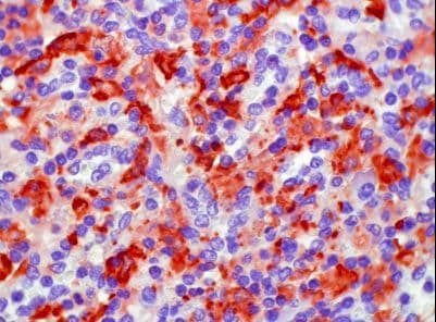 Monoclonal Mouse anti-Human AIF1 / IBA1 Antibody (clone 1022-5, IHC)
