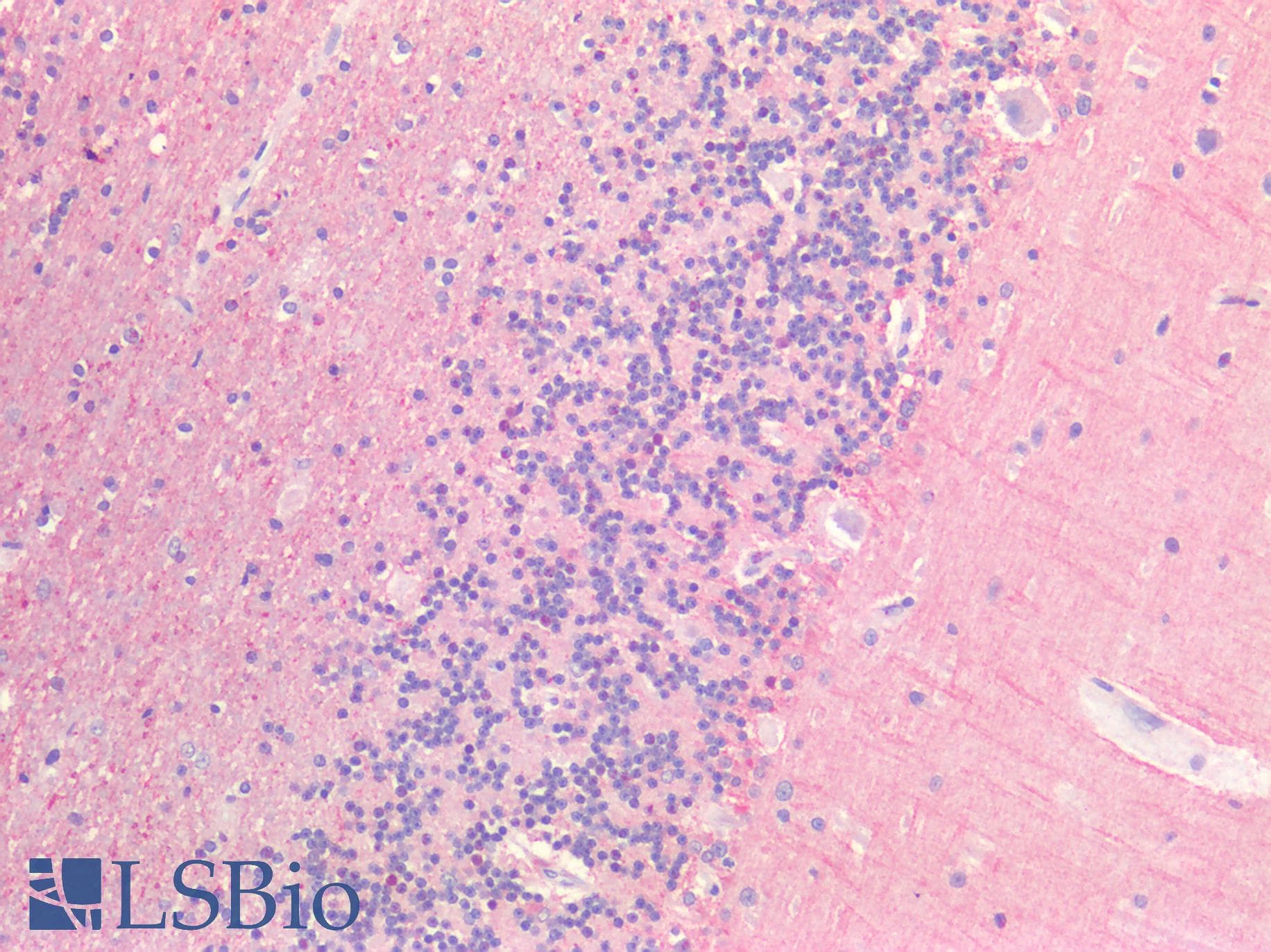 IHC-plus™ Polyclonal Rabbit anti-Human FZD7 / Frizzled 7 Antibody (IHC, WB)