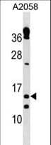 Polyclonal Rabbit anti-Human TXNRD3NB Antibody (aa95-121, WB)