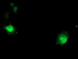 DTNB / Dystrobrevin Beta Antibody (clone OTI3H8)