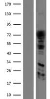 DNM1L / DRP1 Protein (Over-Expression Lysate Myc-DDK (Flag))