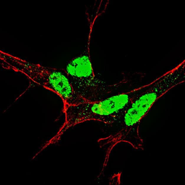 NANOG Antibody (phospho-Ser71)