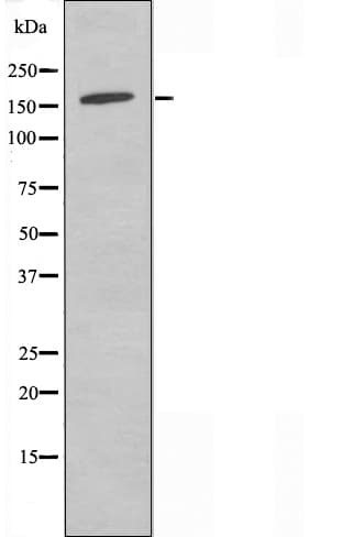 ANKRD30A / NY-BR-1 Antibody