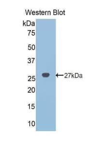 NOG / Noggin Antibody (aa28-232)