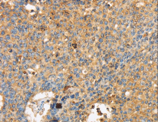 Polyclonal Rabbit anti-Human MAPK6 / ERK3 Antibody (IHC)