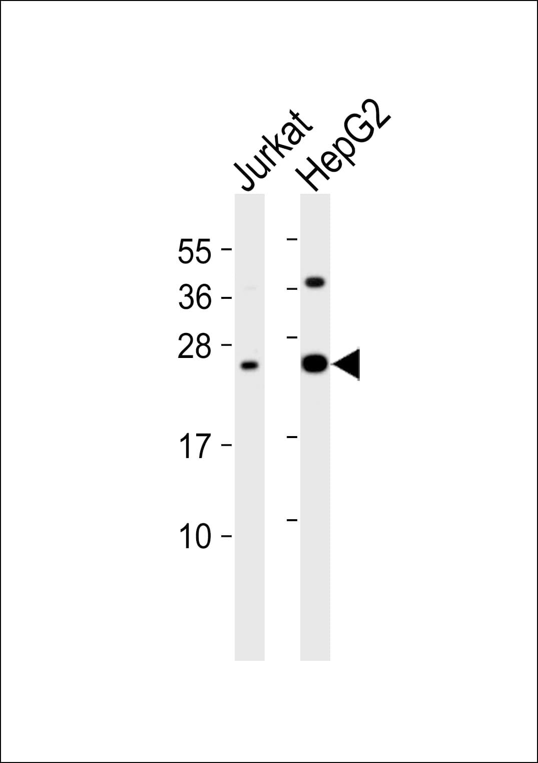 Polyclonal Rabbit anti-Human IFN Gamma / Interferon Gamma Antibody (WB)