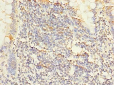 PPAP2C Antibody (aa109-162)