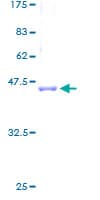 Human CYB5A / Cytochrome b5 Protein (Recombinant GST)