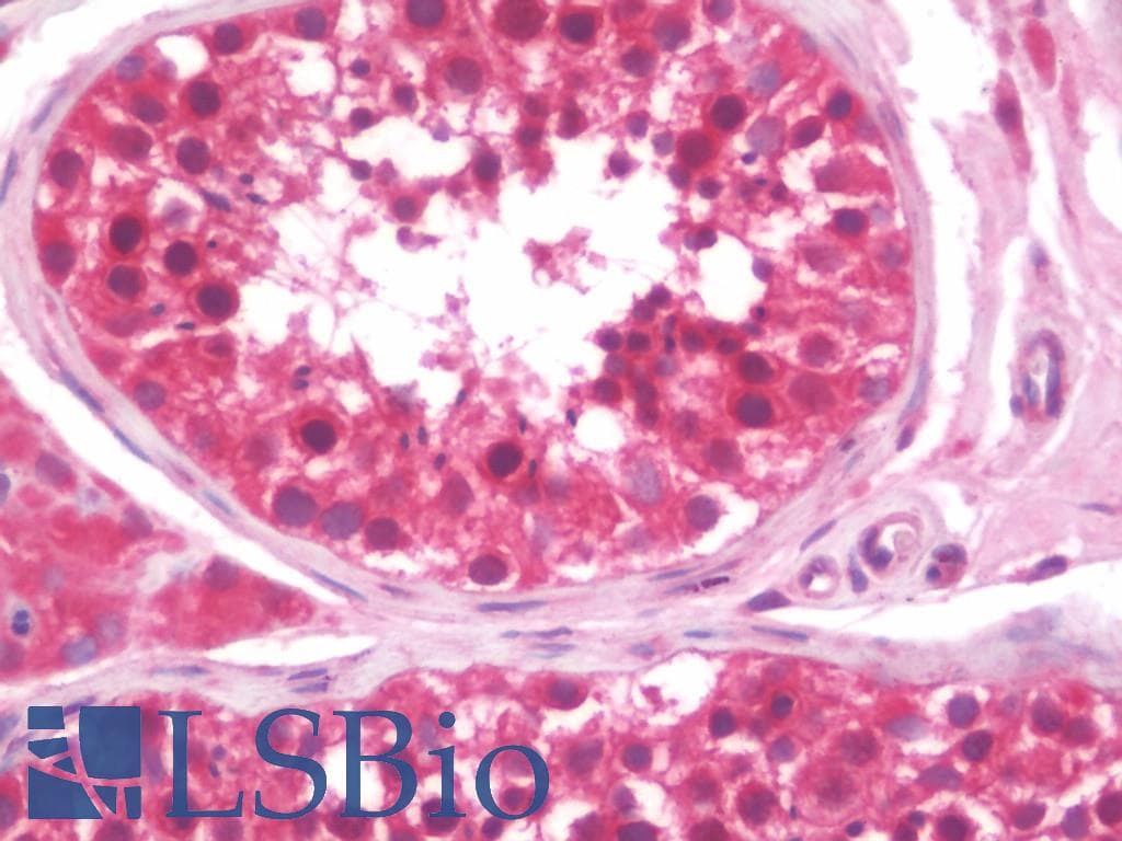IHC-plus™ PHF7 Antibody (clone 1A11)
