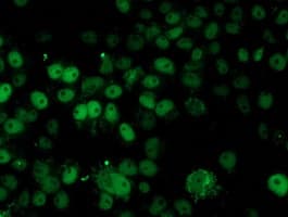 HARS2 Antibody (clone OTI5A9)