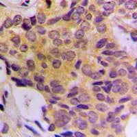 CDK5RAP3 Antibody (Internal)