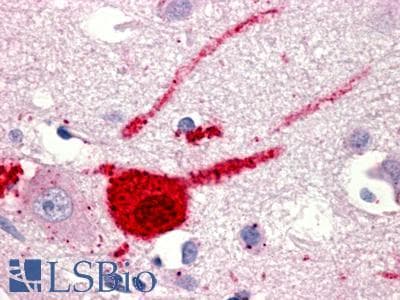 PathPlus™ GPR151 Antibody (C-Terminus)
