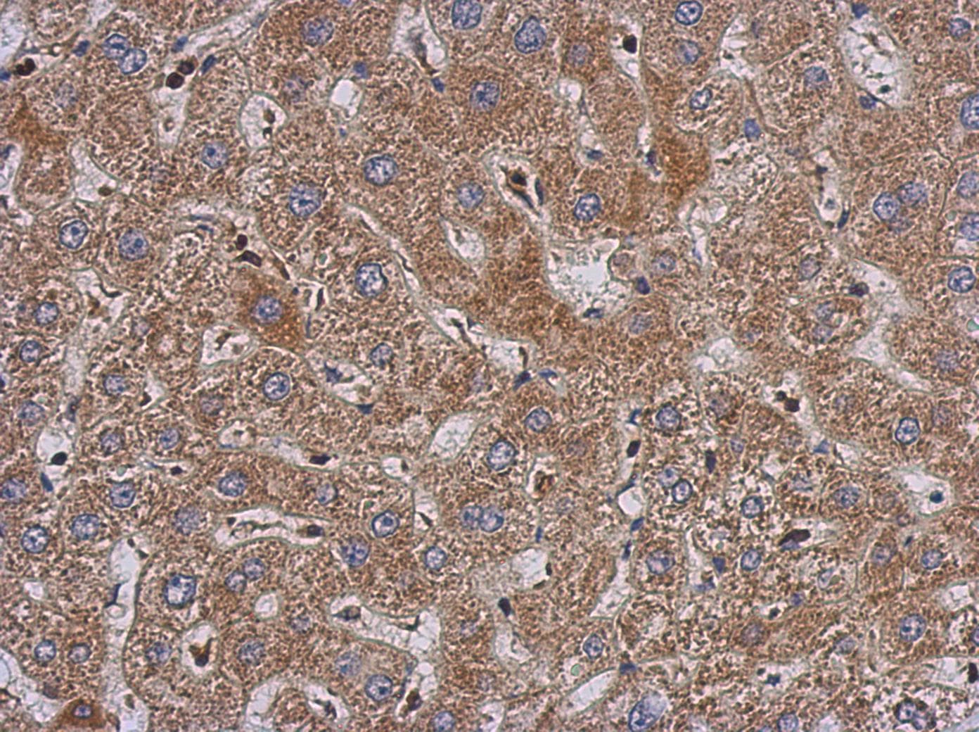 Polyclonal Rabbit anti-Human PABPC3 Antibody (IHC, WB)
