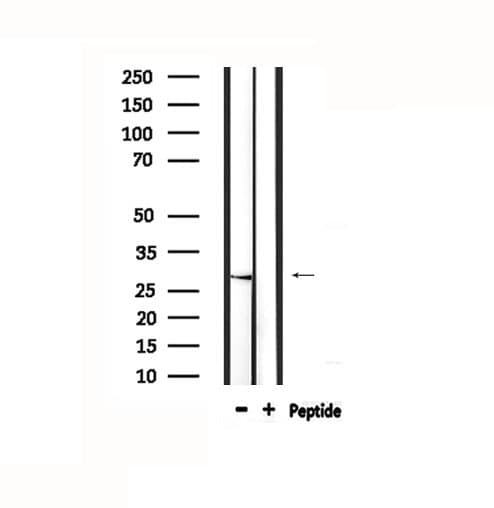 THY1 / CD90 Antibody