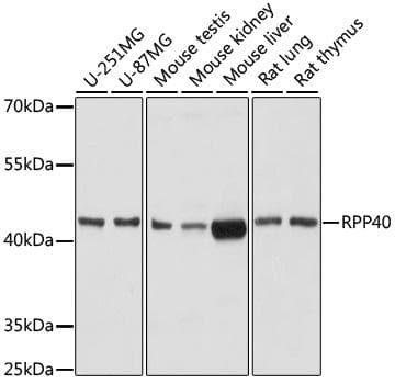 RPP40 / Ribonuclease P Antibody