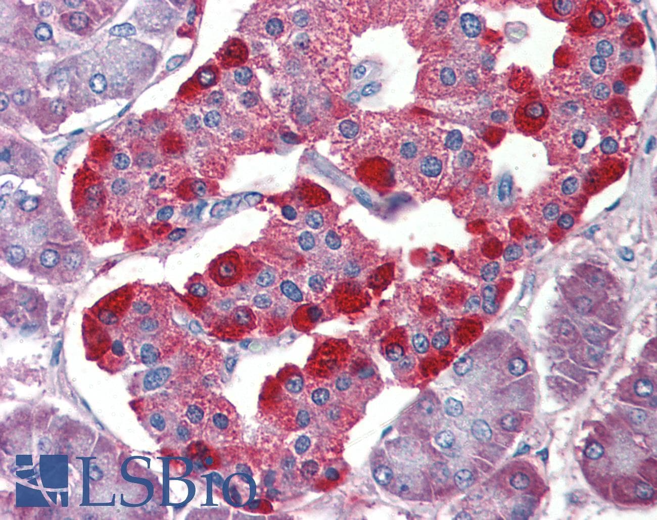 IHC-plus™ Polyclonal Rabbit anti-Human 4E-BP2 / EIF4EBP2 Antibody (aa99-120, IHC, WB)
