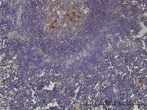 PCNA-Associated Factor Antibody (clone 3C11-1F11)