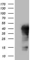 LCX / TET1 Antibody (aa1-305, clone OTI8C3)
