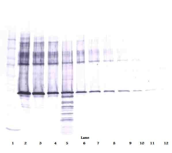 PathPlus™ SERPINB5 / Maspin Antibody