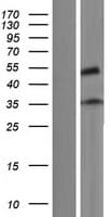 ZNF641 Protein (Over-Expression Lysate Myc-DDK (Flag))