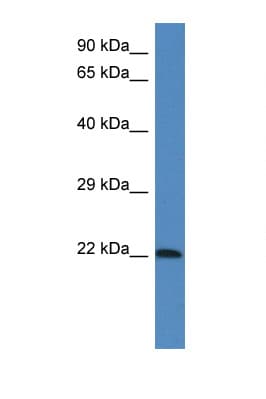 LGALSL / Galectin 5 Antibody (aa73-122)