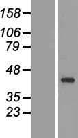 CYTIP Protein (Over-Expression Lysate Myc-DDK (Flag))