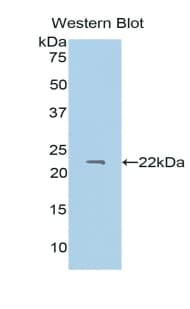 PROS1 / Protein S Antibody (aa301-476, Biotin)