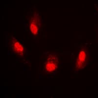 Histone H4 Antibody (Acetyl-Lys8)