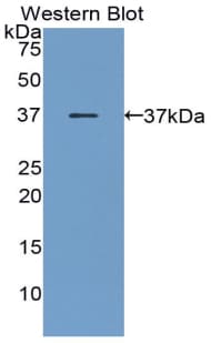 PGC / Pepsin C Antibody (aa61-388)