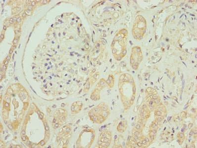 Polyclonal Rabbit anti-Human EMP1 Antibody (IHC)