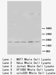 BCL2L1 / BCL-XL Antibody (Internal)