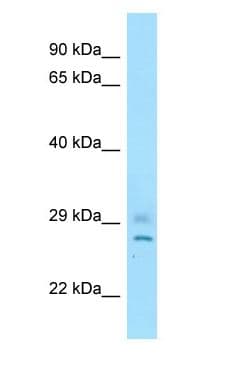 CNOT8 Antibody (C-Terminus)