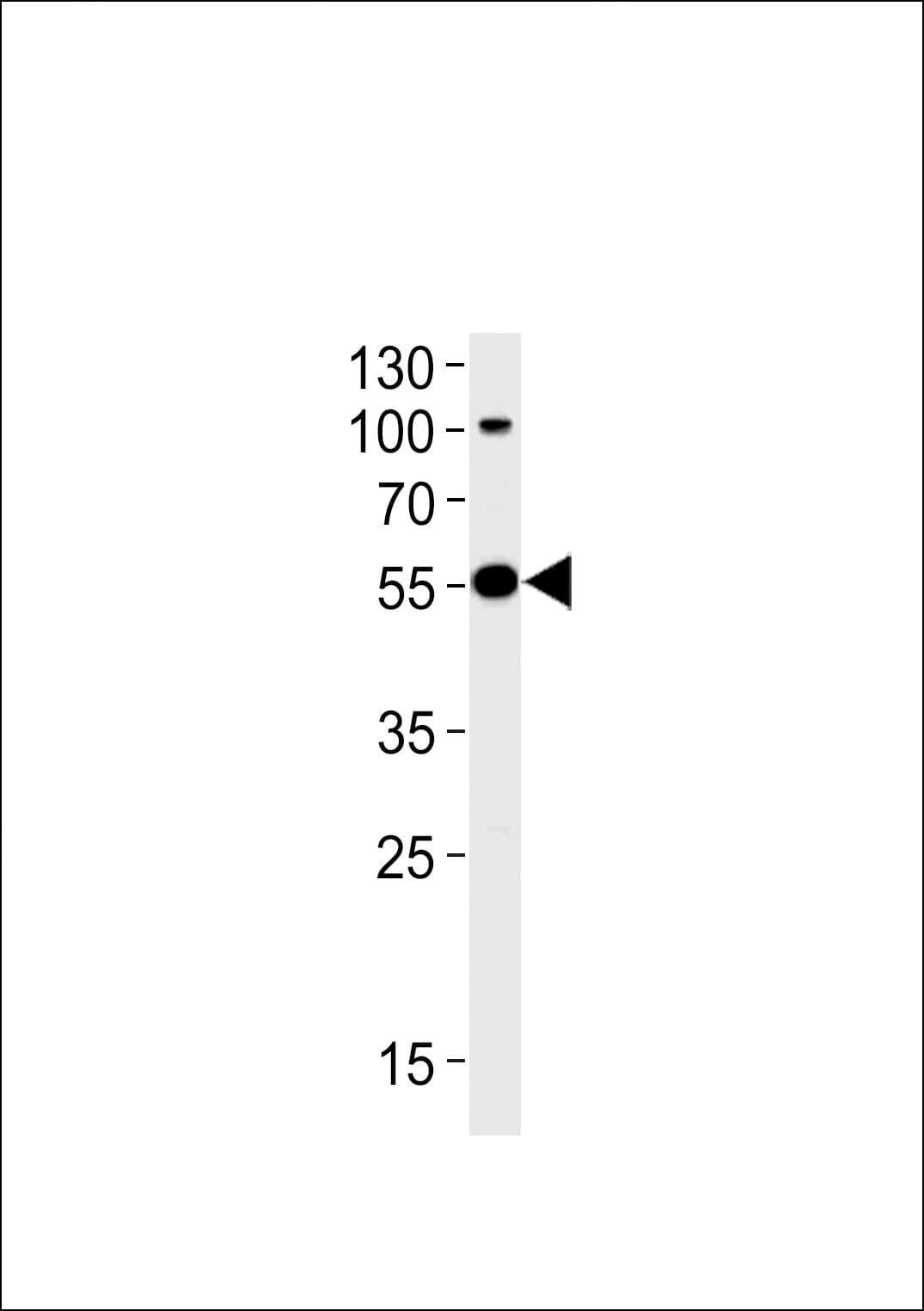 PARK2 / Parkin 2 Antibody (aa111-140)