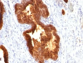 KRT18 / CK18 / Cytokeratin 18 Antibody (clone KRT18/835)
