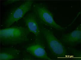 SNAI1 / SNAIL-1 Antibody (clone 2G11)