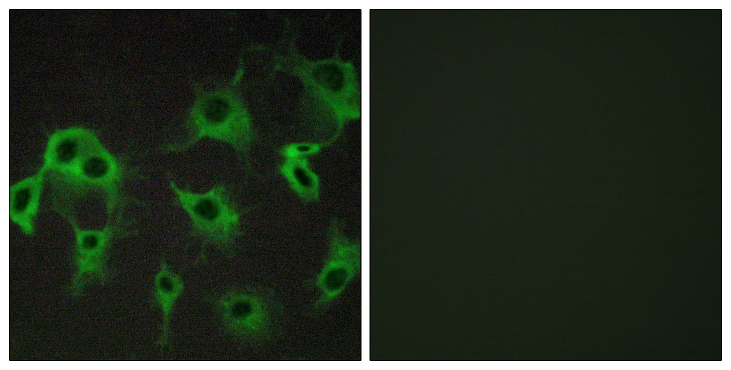IHC-plus™ ADRB2 Antibody (aa336-385)