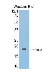 FSCN2 / Retinal Fascin Antibody (aa308-442, PE)