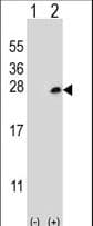 Polyclonal Rabbit anti-Human DOK5 Antibody (WB)