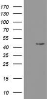PHKG2 Antibody (aa1-216, clone OTI1F9)