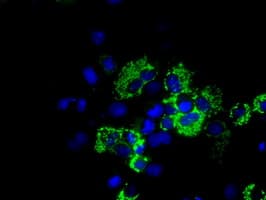 ACO2 / Aconitase 2 Antibody (clone OTI3G10, Carrier-free)
